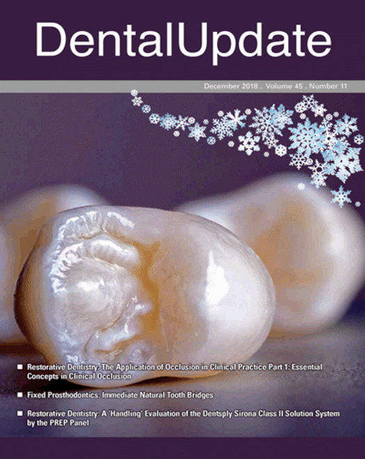 Occlusion in implant dentistry. A review of the literature of