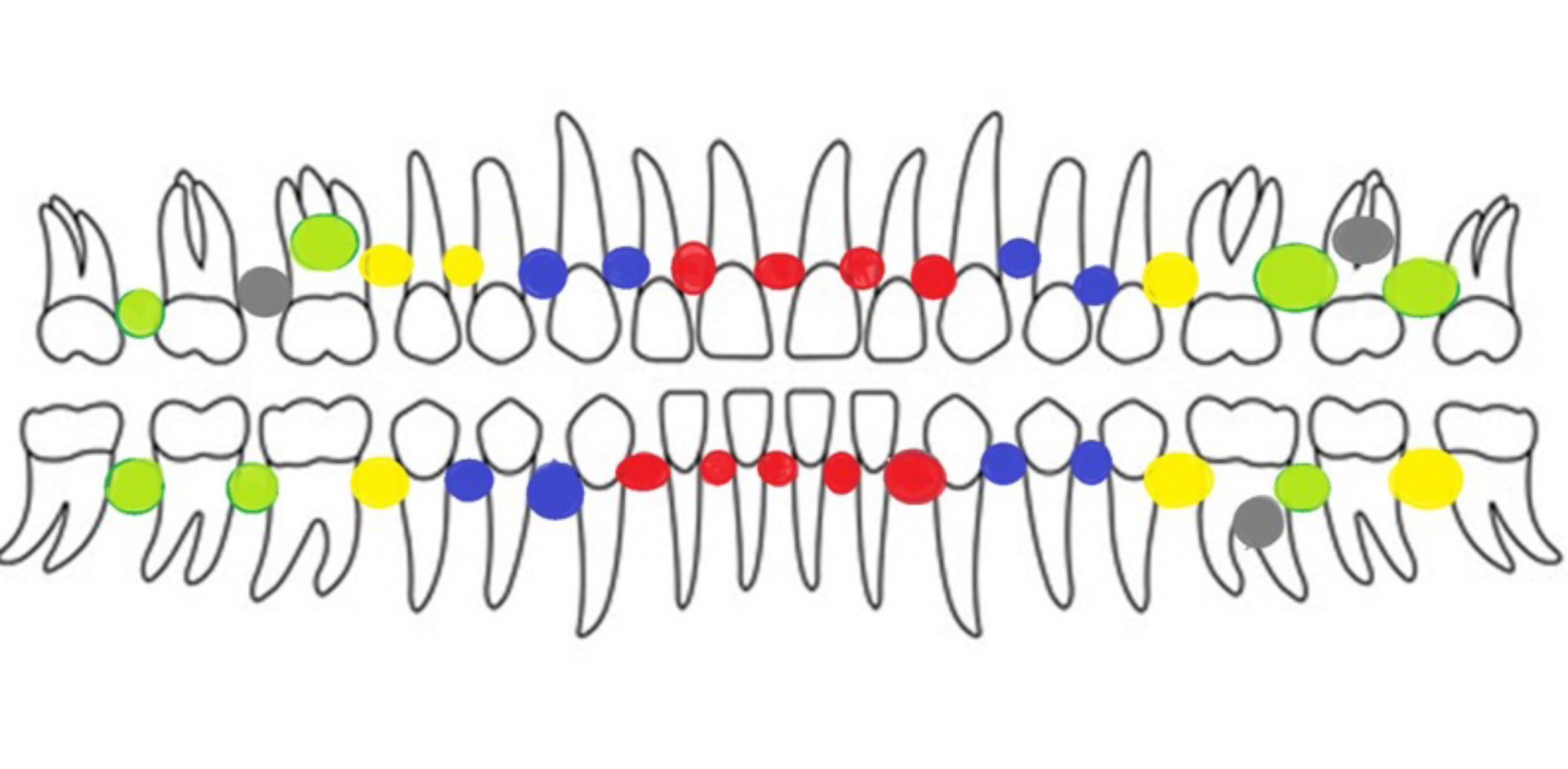 Dental Update Step 1 for the treatment of periodontal diseases